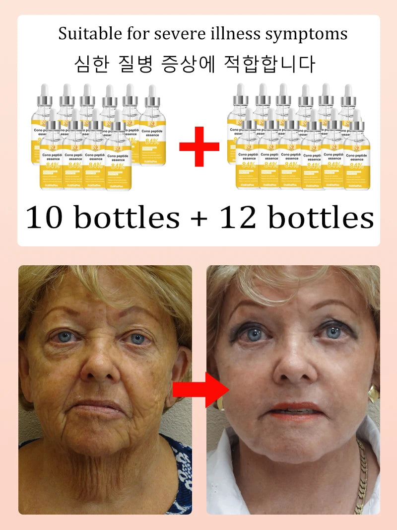 Silicone Skin Rejuvenation Brush for Visible Aging Reduction