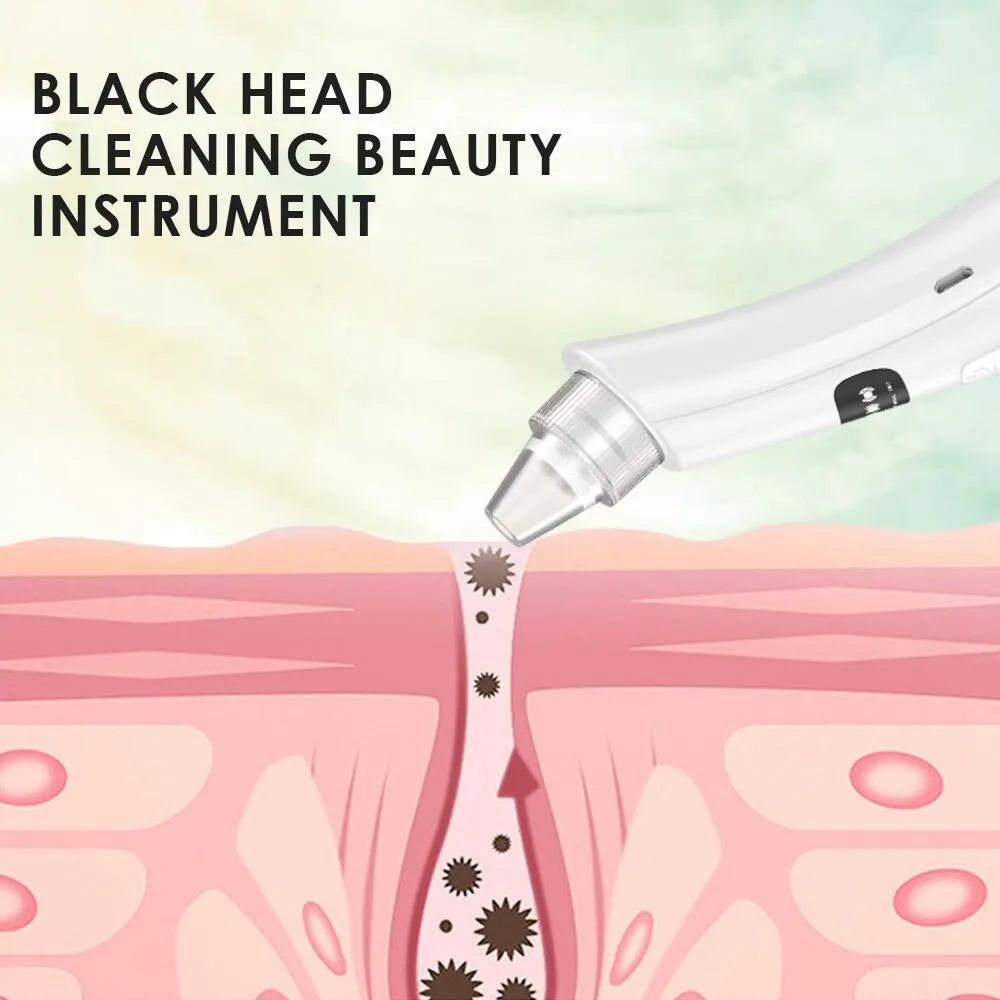 Other Facial Cleansing Beauty Device With 3 Suction Modes