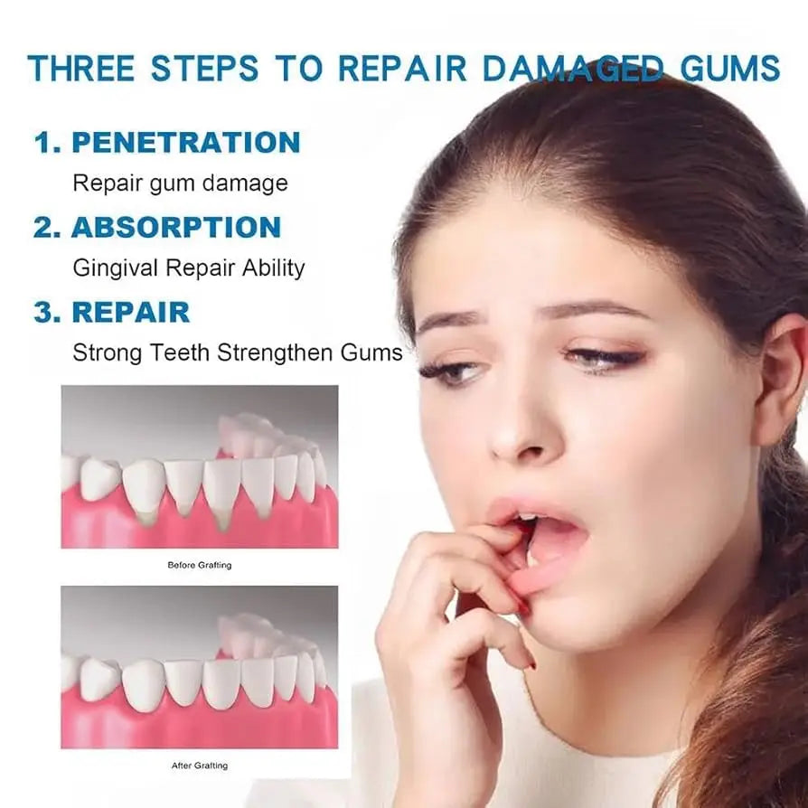 Rapid Repair Gums Gel For Healthy Gums And Teeth Care