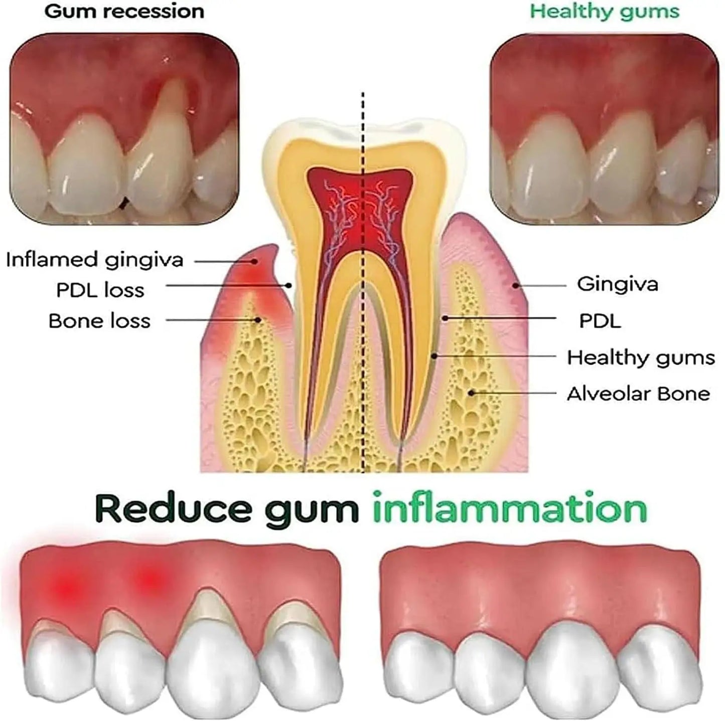 Rapid Repair Gums Gel For Healthy Gums And Teeth Care